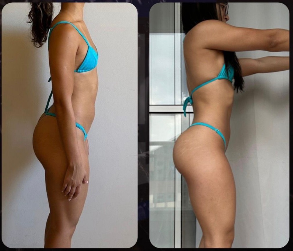 Transformação aluna-1 - imagem 2