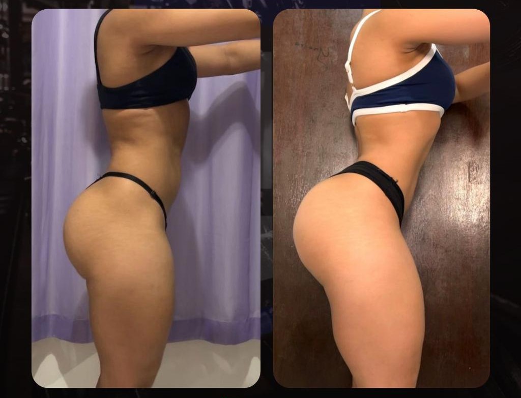 Transformação aluna-4 - imagem 2